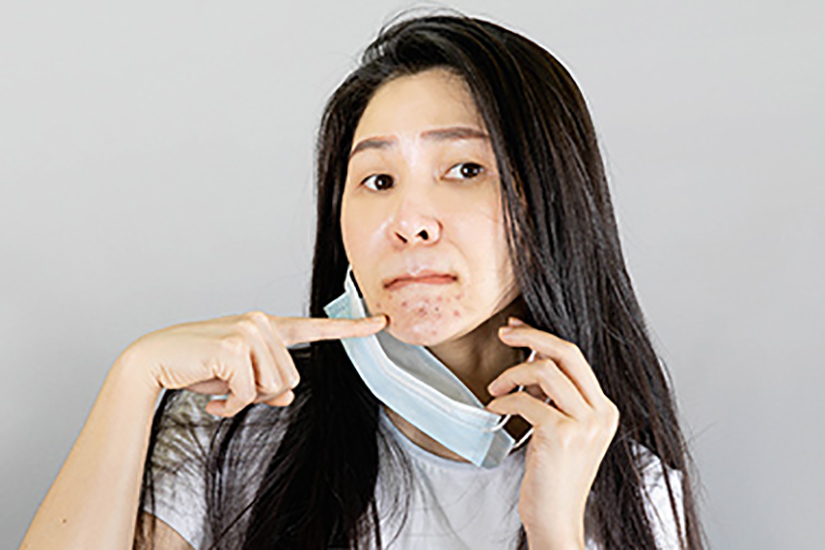 Stress and psoriasis flare-ups